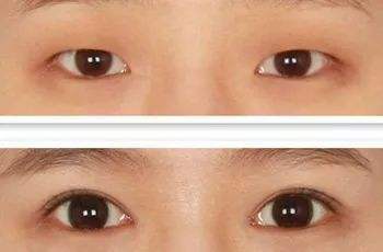 张冰洁整形工作室口碑好吗?贵不贵?概况和案例展示