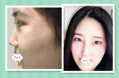 台湾嘉仕美的李进良医生好不好?个人主页和案例展示