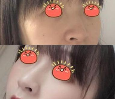 西安医学院附属整形外科金永焕医生的个人简介和相关案例