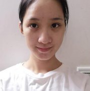 通过激光恢复了困扰了了我5年的痘印痘坑,这是一个多么让人激动的事儿