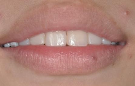 感谢成都博爱现在的我爱死了如今的白牙,终于可算能开口大笑了