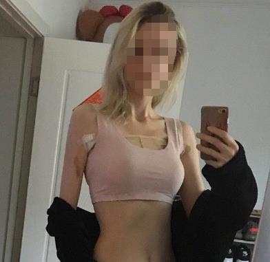 张高贵医生的隆胸案例和个人信息介绍