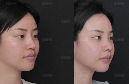 冯雁平医生的鼻案例展示和个人信息简介