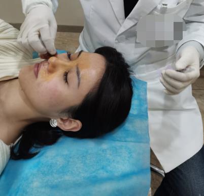 黄志祥的隆鼻案例怎么样?附个人简介