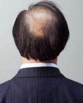 北京壹加壹苏彬医生怎么样？贵不贵？案例和简介