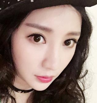 张冰洁双眼皮果怎么样？价格是多少？简介和案例展示