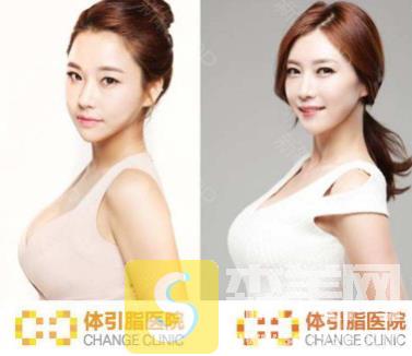 韩国体引脂整形医院怎么样?热门项目是哪些?医生团队介绍&价目表展示