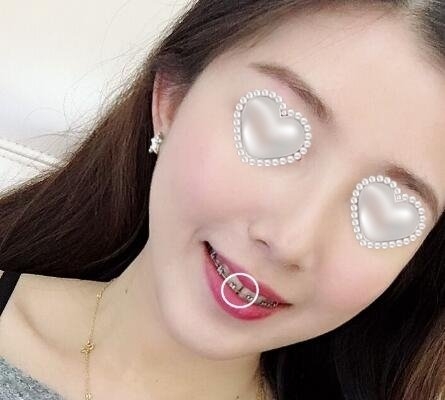 厦门天使口腔美容医院的情况?医生介绍_案例展示_口碑详情