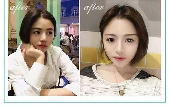 上海富华美容医院的情况?医生介绍_案例展示_口碑详情