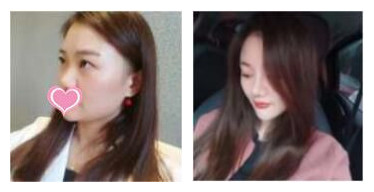 陶宏炜整形医生个人主页情况?案例展示_口碑_上海颜范整形