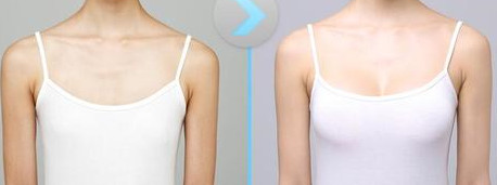 王忠志整形医生个人主页情况?案例展示_口碑情况_杭州瑞丽整形