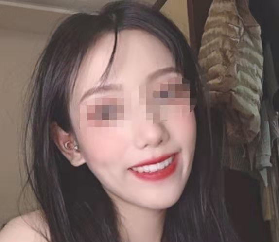 成都华西医院口腔科怎么样，医生介绍，矫正案例，价格参考