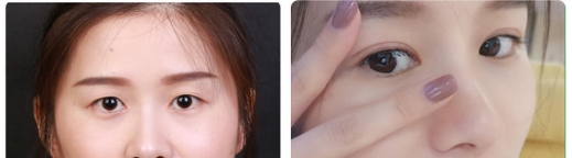 深圳美莱美容医院的口碑如何-案例展示-医生介绍-项目价格