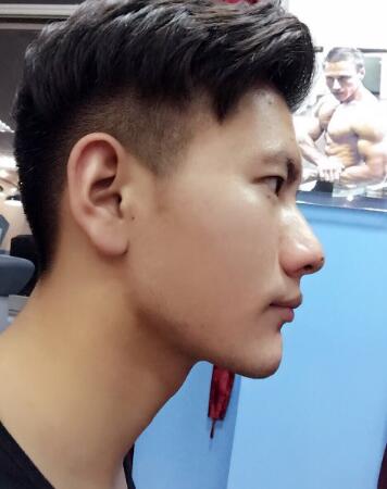 在成都华西口腔医院做的牙齿矫正果超赞,让三十岁的我中午敢笑了