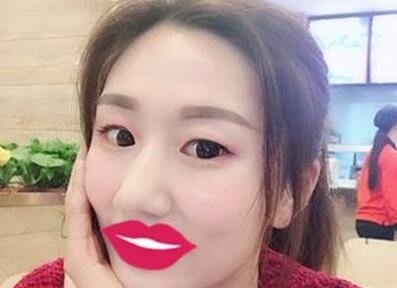 侯典举修复能力真是让我刮目相看,同时走出了失败的阴影