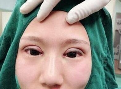 侯典举修复能力真是让我刮目相看,同时走出了失败的阴影