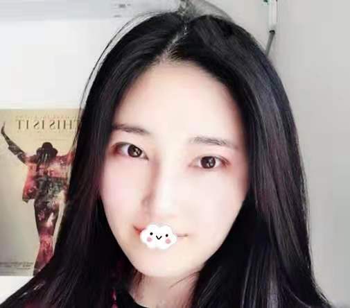 整形医生陈群的技术水平-案例介绍-项目价格-深圳阳光美容医院