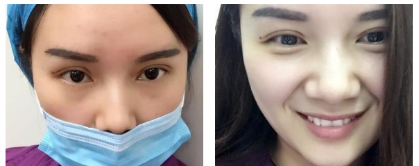 郑州华山整形医院的简介-医生团队-案例展示-项目价格