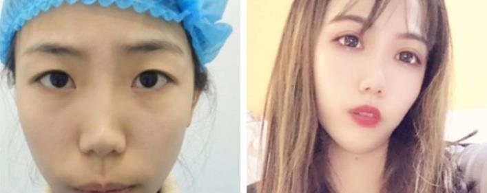 郑州大学第五附属医院整形科简介-医生团队-案例展示-项目价格