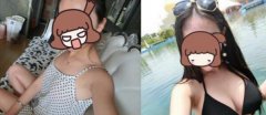 在上海华美做了自体隆胸手术后，让我有了女人味