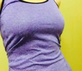 整形医生王勇大的技术水平怎样-案例展示-项目价格-天津维美整形医院