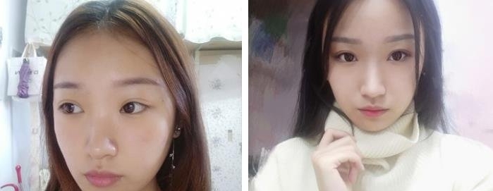 常州市第三人民医院整形美容科的简介-案例展示-医生介绍-项目价格