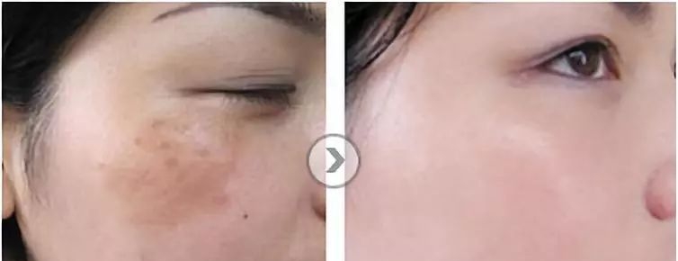 苏州美贝尔医疗美容医院情况-案例展示-医生团队-项目价格