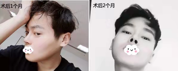 四川友谊医院整形美容科的技术水平怎样-案例介绍-项目价格-医生团队