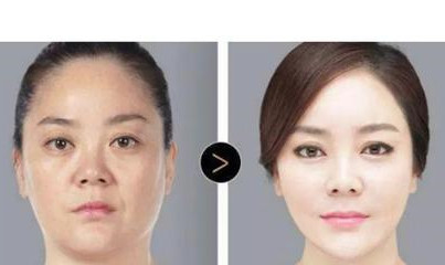 孙凤云整形医生个人主页情况?沈阳协和医院_案例展示_口碑情况