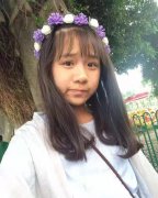 上海杨杰给我做的隆鼻果，太赞了！