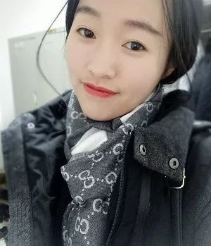 在上海江城皮肤医院做的嫩肤果不错