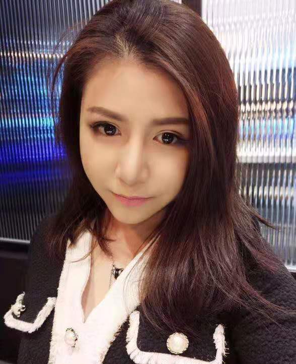 在初美医疗美容医院进行了面部吸脂，终于让我摆脱掉了大脸猫