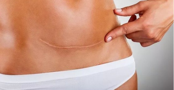 上海疤痕修复医院哪里比较好？术后果怎么样？