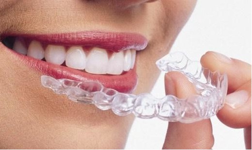 沈阳牙齿矫正多少钱,有多少纠正的方法?