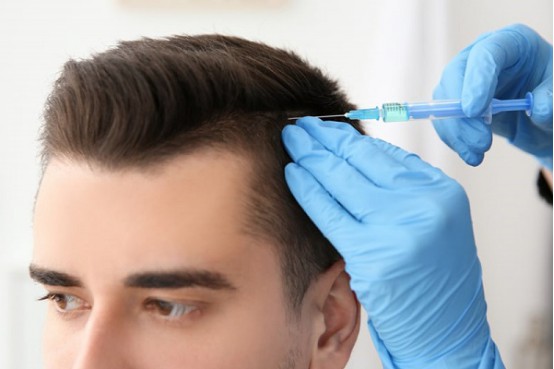 fut植发和fue植发的区别在哪里,两种方式该如何选择?