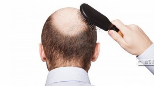 大麦微针植发怎么样?到底靠不靠谱,值得选择吗?