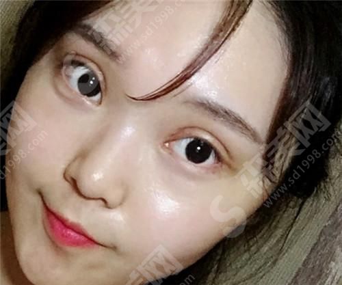 大连新华美天医疗美容医院怎么样?医生技术+真实整形案例!