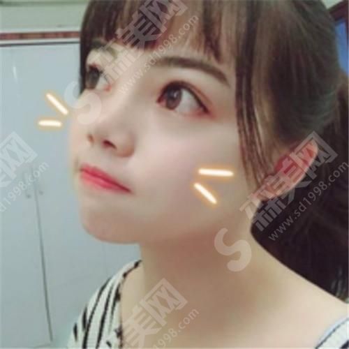 深圳三甲医院有热玛吉吗? 医院简介/龙云整形案例分享/价格表