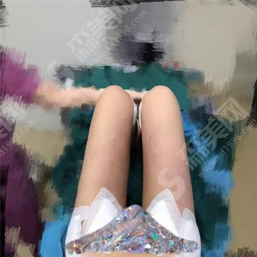 沈阳医大一院美容科郭澍医生整形案例 沈阳医大一院美容科电话可以打吗?专家介绍+真实案例分享