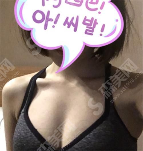 营口协和整形医院柳大烈手术案例 营口协和整形医院价格表较新呈现!专家介绍+案例分享(附照片)