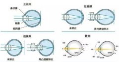 南昌近视手术较好的医院有哪些？第一附属，94医院，县人民医院介绍都有