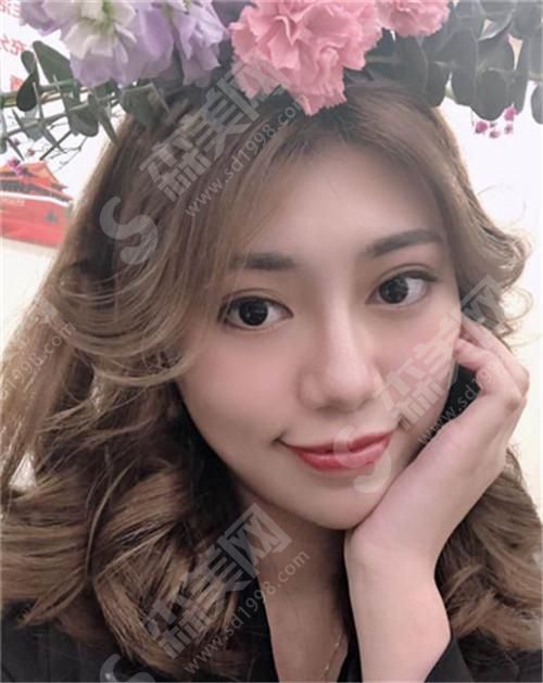 真实的热玛吉flx5代案例感受