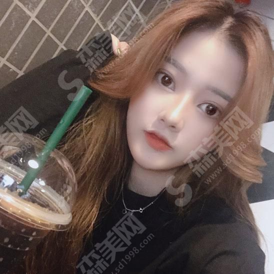 深圳北大李天石做的双眼皮怎么样&李天石医生的技术怎么样？双眼皮真人案例