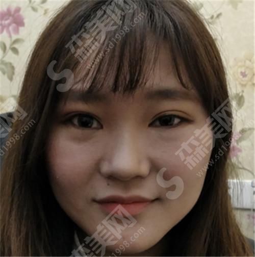 潍坊附属医院卢小生整形案例 潍坊附属医院卢小生是?医院概况+案例真实分享(附照片)