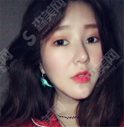 潍坊附属医院卢小生整形案例 潍坊附属医院卢小生是?医院概况+案例真实分享(附照片)