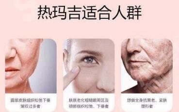 热玛吉全脸一次多少钱与什么有关联? 热玛吉全脸一次多少钱?操作过程?有什么副作用呢!