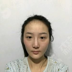 1629630114518031.jpg 沈阳元辰整形医院怎么样?医院的技术/医院的优势/医生介绍&附带的隆鼻案例