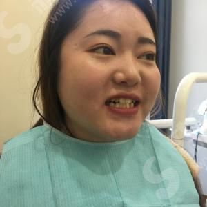 宁波口腔医院的牙齿矫正.jpg