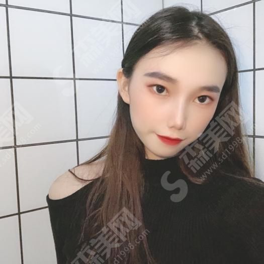 热玛吉做一次有果吗？热玛吉的优势/果/流程/真人案例的果图！