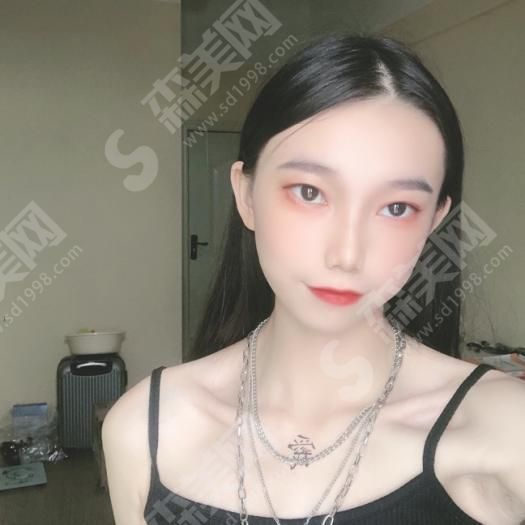 热玛吉做一次有果吗？热玛吉的优势/果/流程/真人案例的果图！